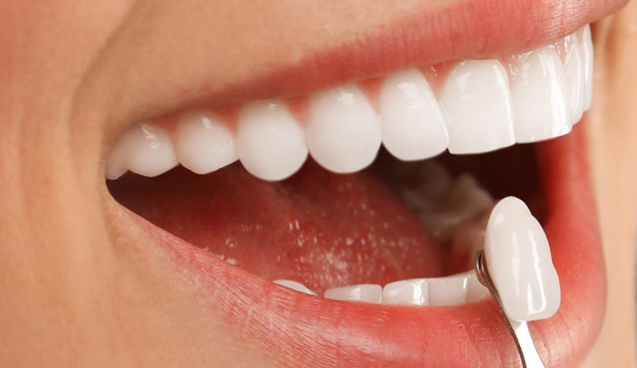 Manningtree Dental -Advanced Implants