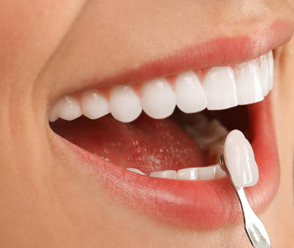 Manningtree Dental -Advanced Implants