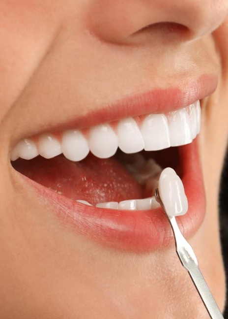 Manningtree Dental -Advanced Implants