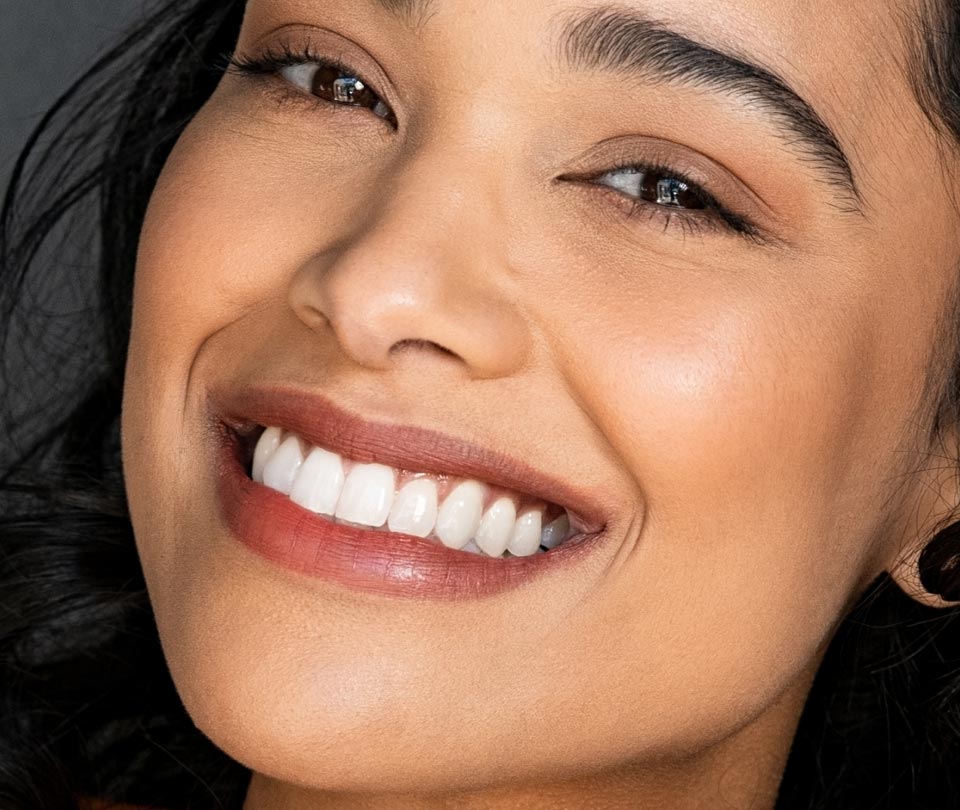 Manningtree Dental - Composite Edge Bonding