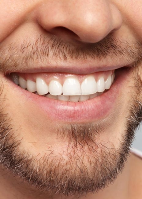 Manningtree Dental - Cosmetic Dentistry At A Glance