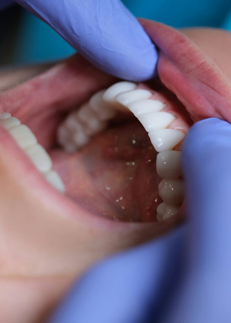 Manningtree Dental - Cosmetic dentures