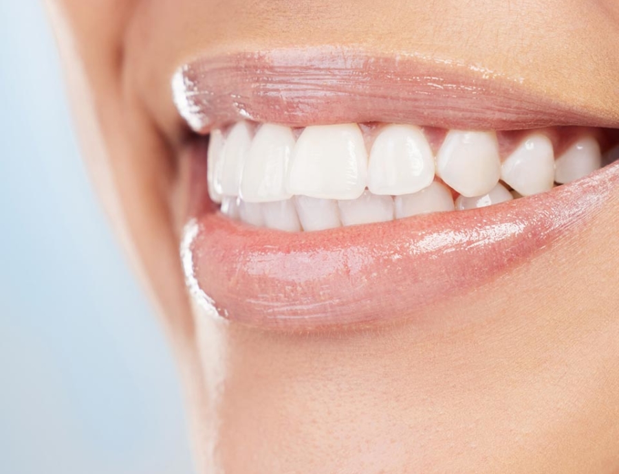 Manningtree Dental - Full Arch Implants