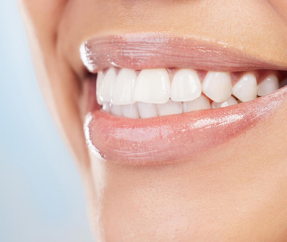 Manningtree Dental - Full Arch Implants