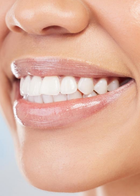 Manningtree Dental - Full Arch Implants