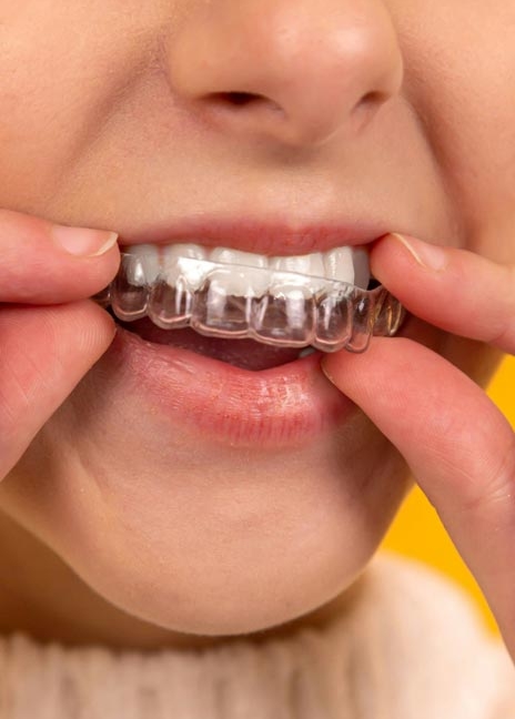 Manningtree Dental - Invisalign
