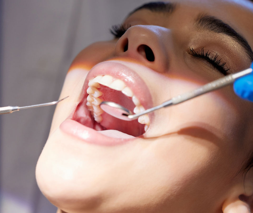 Manningtree Dental - Mouth cancer screening