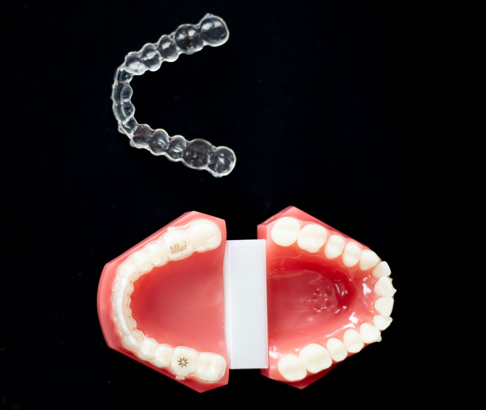 Manningtree Dental - Mouthguards