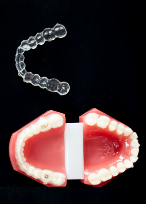 Manningtree Dental - Mouthguards