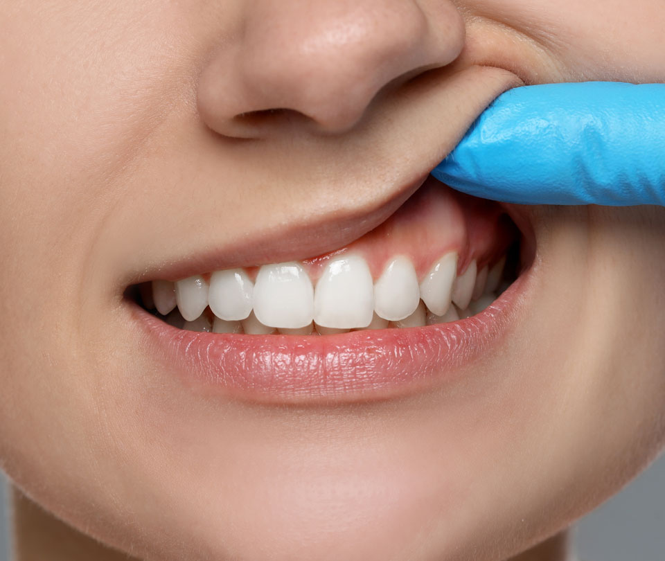 Manningtree Dental - Periodontal treatment (gums)