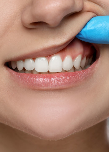Manningtree Dental - Periodontal treatment (gums)