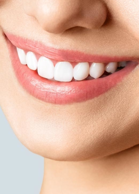 Manningtree Dental - Porcelain Veneers