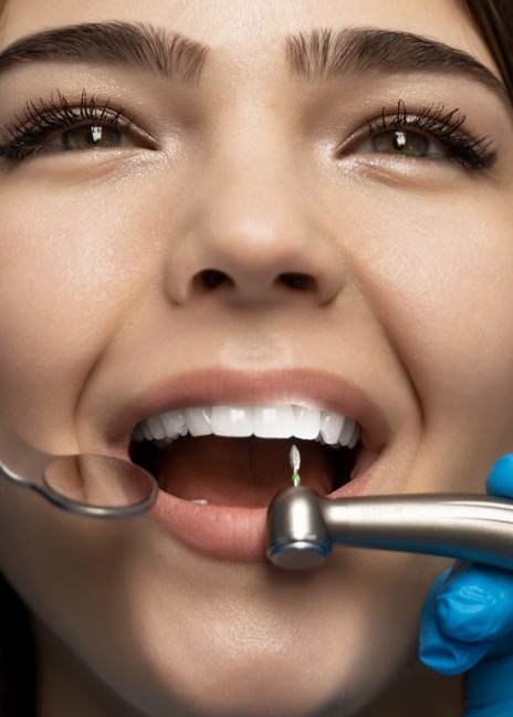 Manningtree Dental - Re root canal treatment