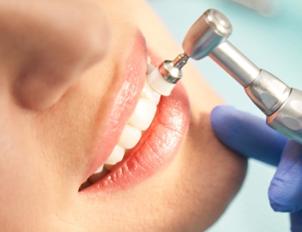 Manningtree Dental - Scale & Polish