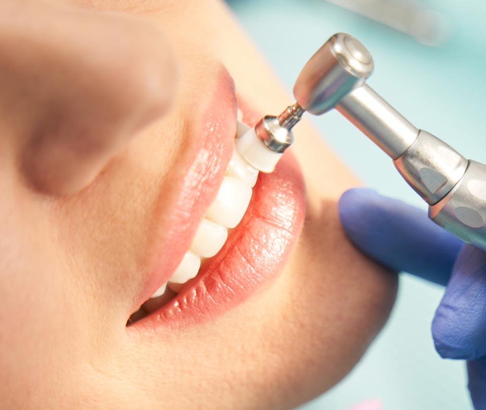 Manningtree Dental - Scale & Polish