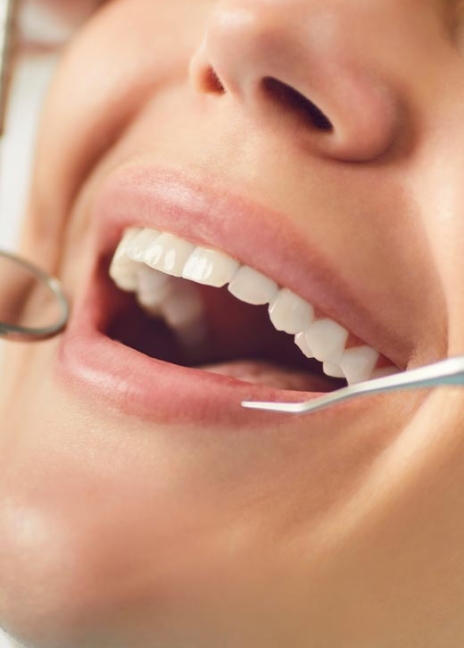 Manningtree Dental - Smile Makeover