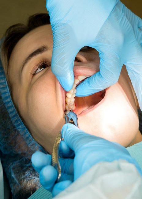 Manningtree Dental - Tooth Extraction
