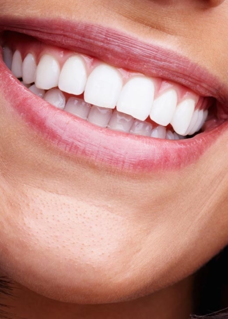 Manningtree Dental - Tooth Whitening