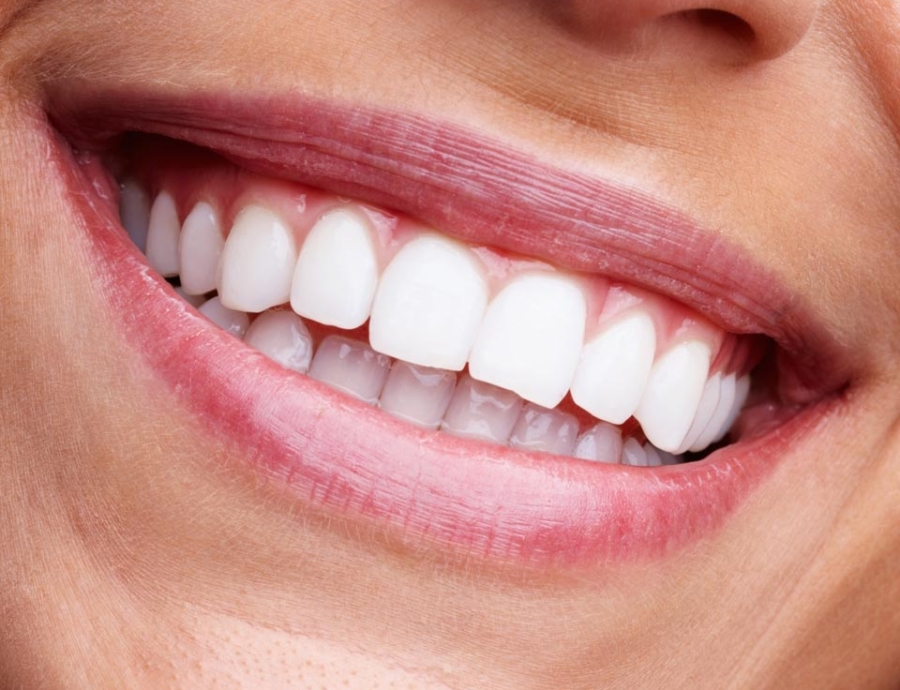 Manningtree Dental - Tooth Whitening