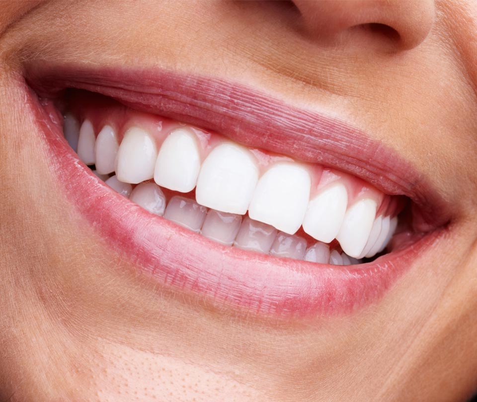 Manningtree Dental - Tooth Whitening