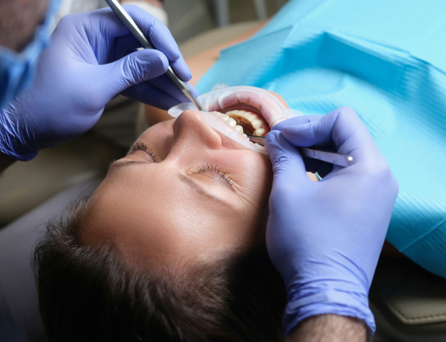 Manningtree Dental - Tooth coloured fillings