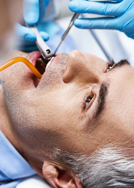 Manningtree Dental - Tooth coloured fillings