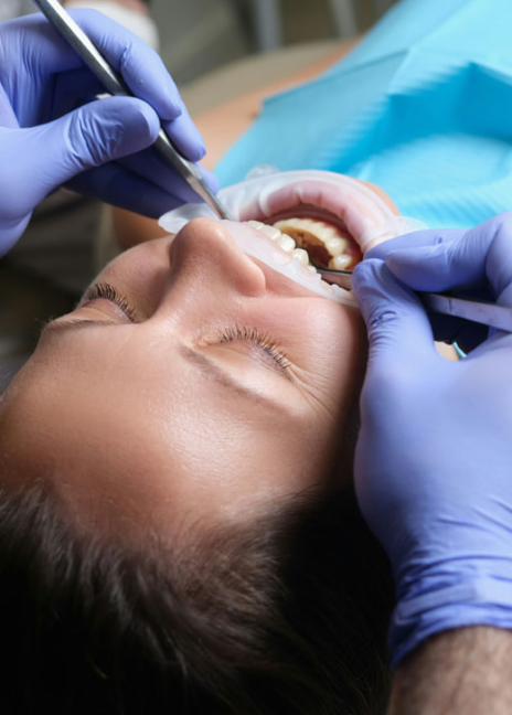 Manningtree Dental - Tooth coloured fillings