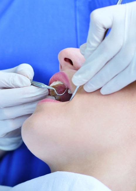 Manningtree Dental - Wisdom Teeth