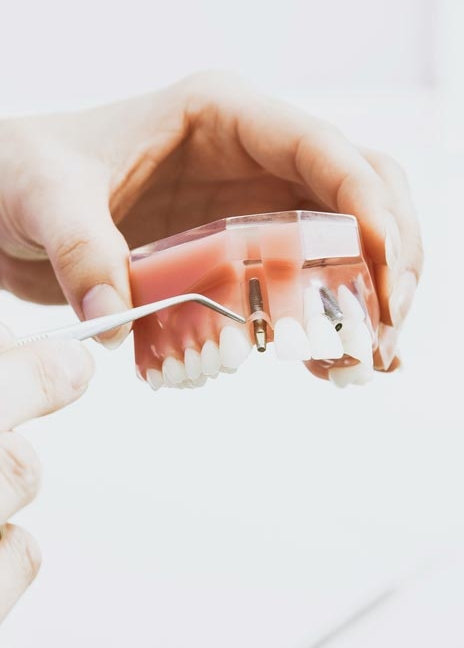 Manningtree Dental - implants and Oral Surgery - At A Glance