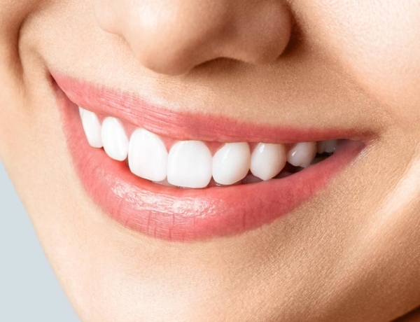 Manningtree Dental - Porcelain Veneers