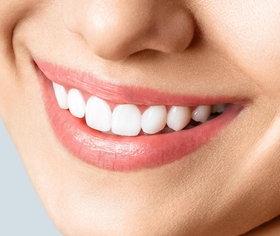 Manningtree Dental - Porcelain Veneers