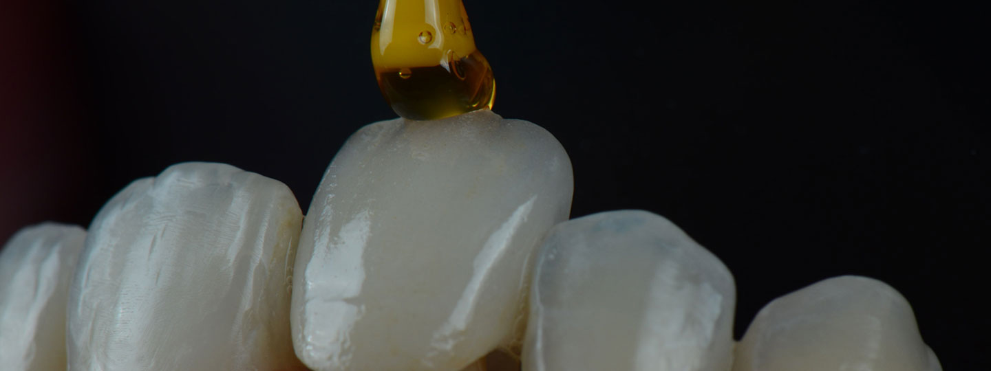 Crowded Teeth - Manningtree Dental