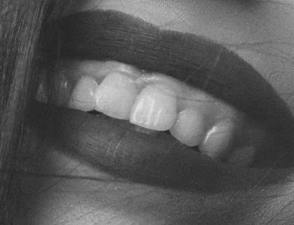 Gummy Smile - Manningtree Dental