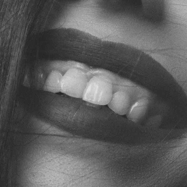 Gummy Smile - Manningtree Dental