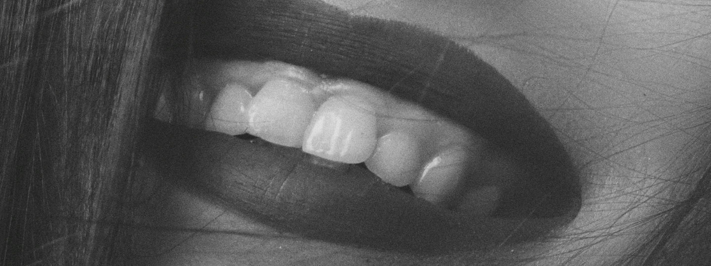 Gummy Smile - Manningtree Dental