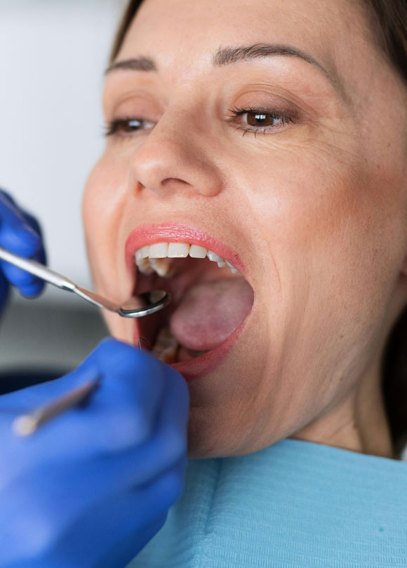 Manningtree Dental - Broken Teeth Common Causes