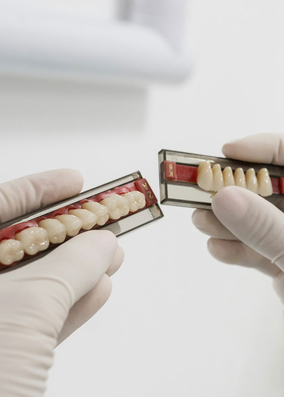 Manningtree Dental - Missing Teeth Common Causes