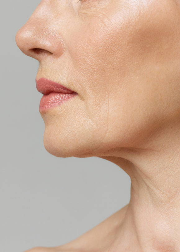 Manningtree Dental - Wrinkles and fine lines Common Causes