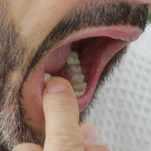 Wobbly Teeth - Manningtree Dental