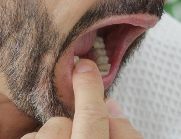 Wobbly Teeth - Manningtree Dental