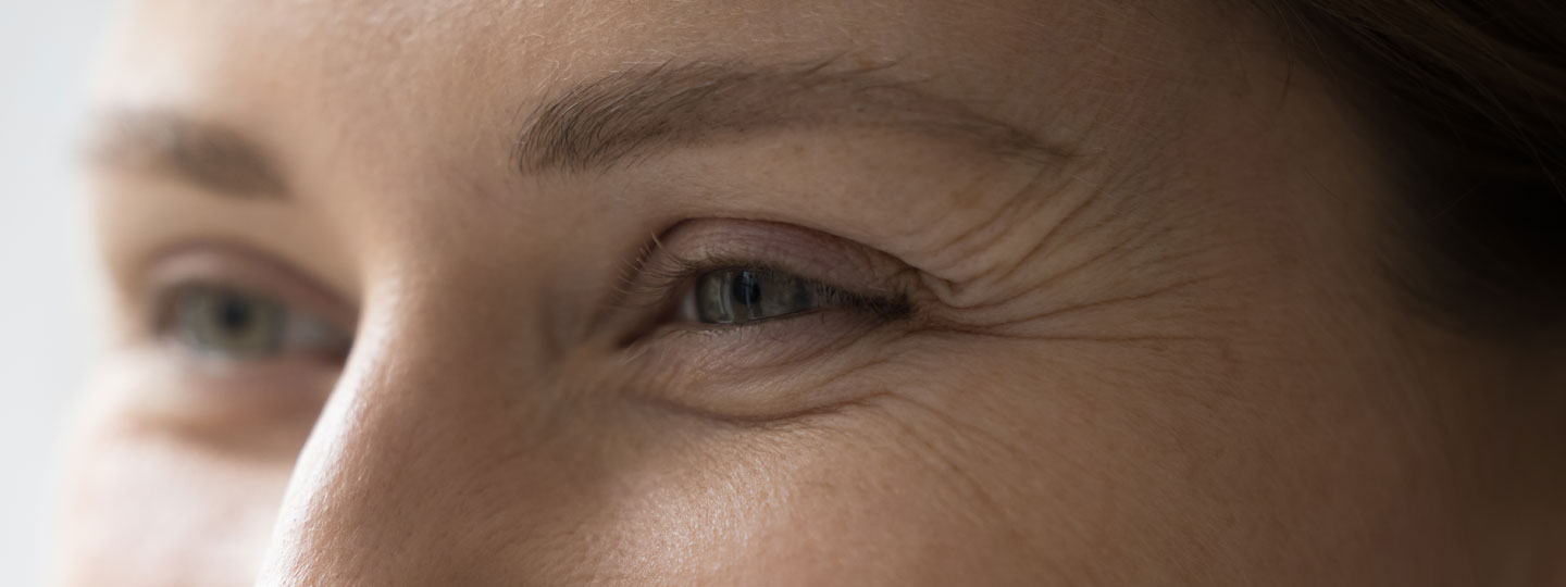 Wrinkles & Fine Lines - Manningtree Dental