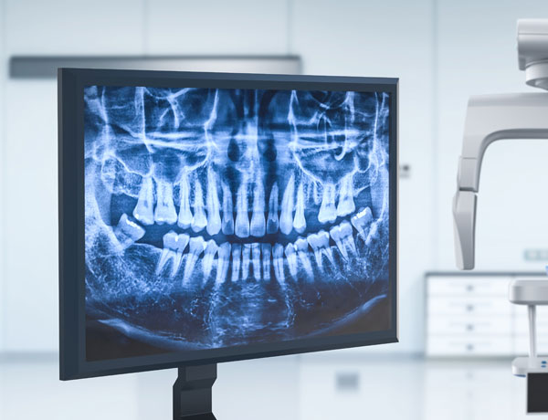 Manningtree Dental - Dental Panoramic Tomograph