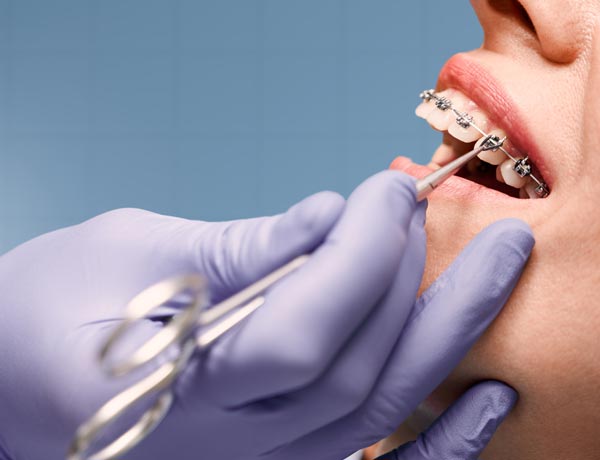 Manningtree Dental - Orthodontic Package